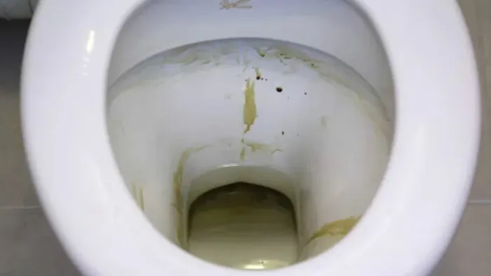 Le nettoyant naturel dont vos toilettes désagréables ont besoin