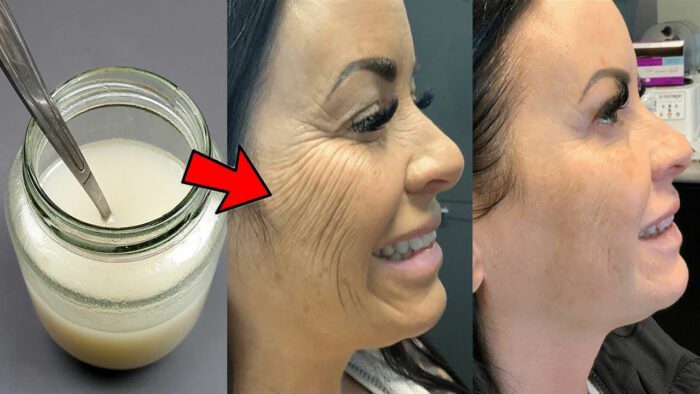 Comment faire le Masque Maizena à effet botox pour éliminer les rides en rien de temps