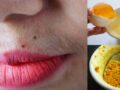 Comment s’épiler les poils sur les lèvres à la maison avec ces 5 remèdes de grand-mère