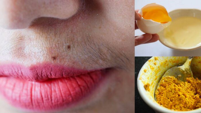 Comment s’épiler les poils sur les lèvres à la maison avec ces 5 remèdes de grand-mère