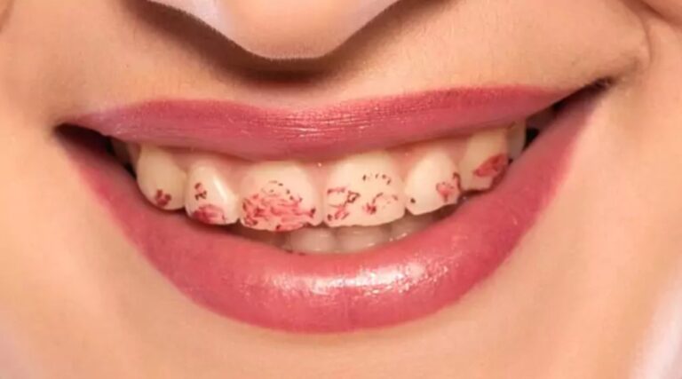 Ennuyé par les marques de rouge à lèvres sur vos dents ? Une maquilleuse professionnelle a révélé une astuce pour éviter cela  