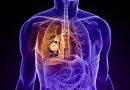Dépister à temps le cancer du poumon afin de mieux le traiter