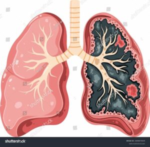 Selon Sciensano, même si le tabagisme recule, il reste beaucoup à faire pour un avenir sans tabac